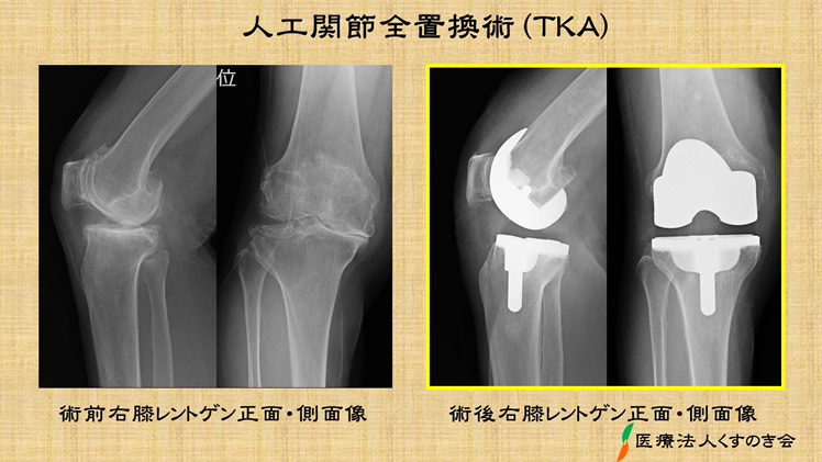 膝が痛い 医療法人 くすのき会